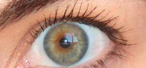 Une conférence sur la DMLA