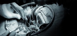 Photographie et monde médical : Natacha Sibellas expose au coeur du bloc place des Carmes